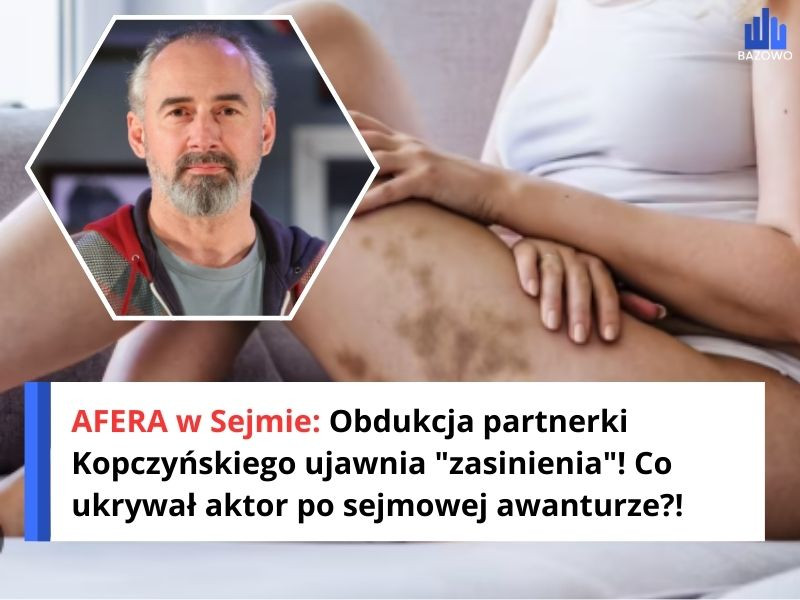 AFERA w Sejmie: Obdukcja partnerki Kopczyńskiego ujawnia "zasinienia"! Co ukrywał aktor po sejmowej awanturze?!